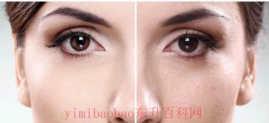 肤色暗沉怎么办变白（都说“一白遮百丑”，皮肤黯黄的人怎么才能变白？）