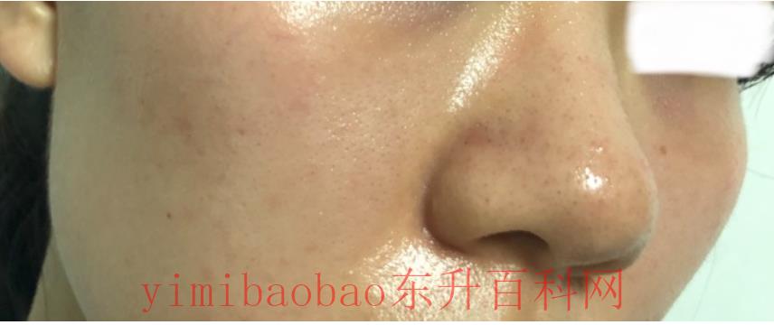 肤色暗沉怎么办变白（都说“一白遮百丑”，皮肤黯黄的人怎么才能变白？）
