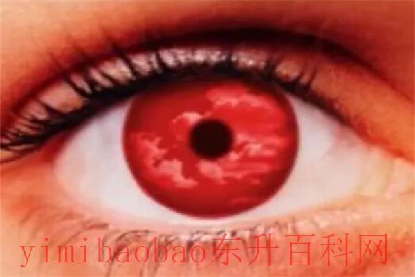 全球最稀有的眼睛：紫色眼睛(仅有600人拥有)